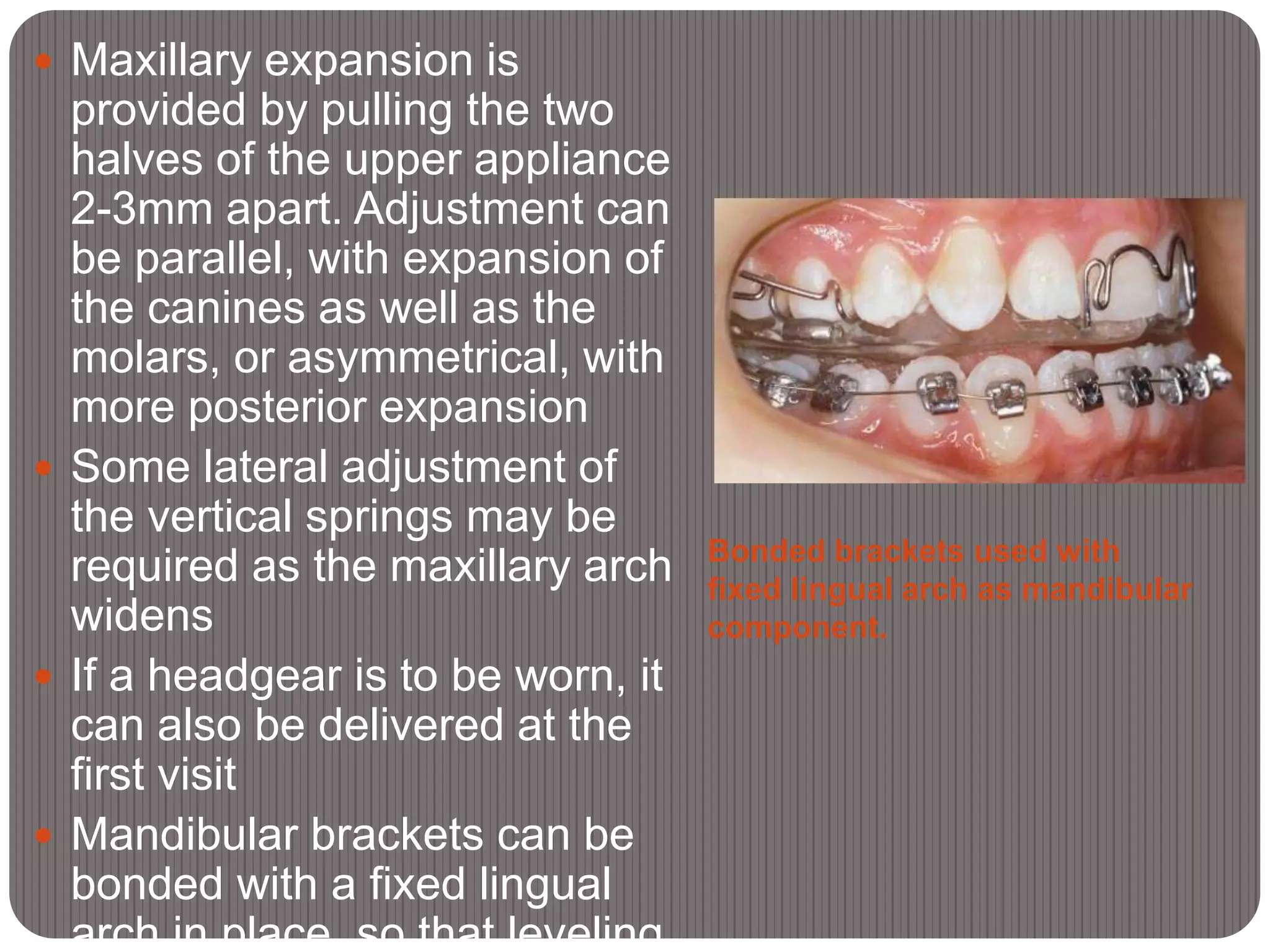 Bonded brackets used with
fixed lingual arch as mandibular
component.
 Maxillary expansion is
provided by pulling the two
halves of the upper appliance
2-3mm apart. Adjustment can
be parallel, with expansion of
the canines as well as the
molars, or asymmetrical, with
more posterior expansion
 Some lateral adjustment of
the vertical springs may be
required as the maxillary arch
widens
 If a headgear is to be worn, it
can also be delivered at the
first visit
 Mandibular brackets can be
bonded with a fixed lingual
arch in place, so that leveling
 