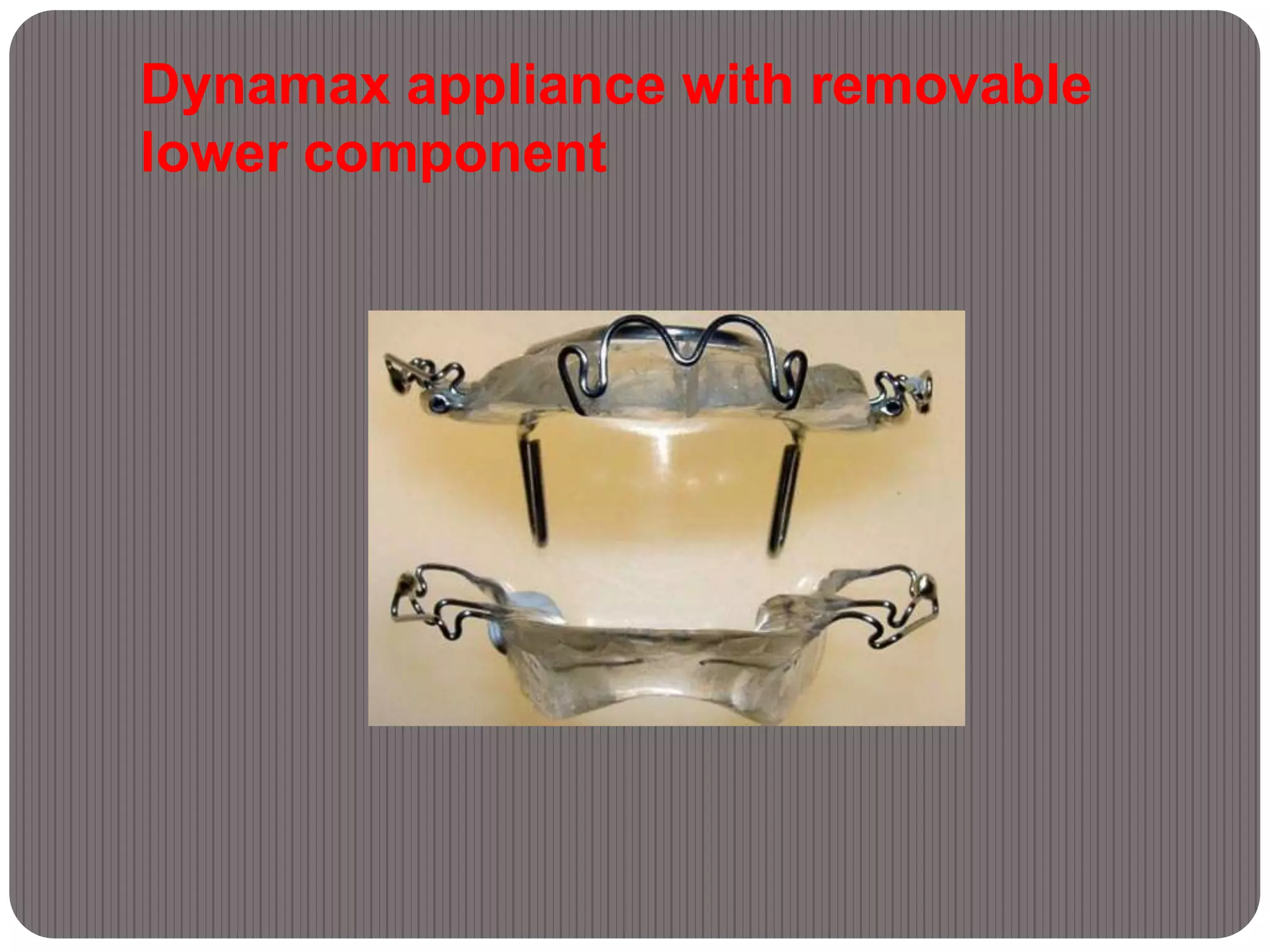 Dynamax appliance with removable
lower component
 