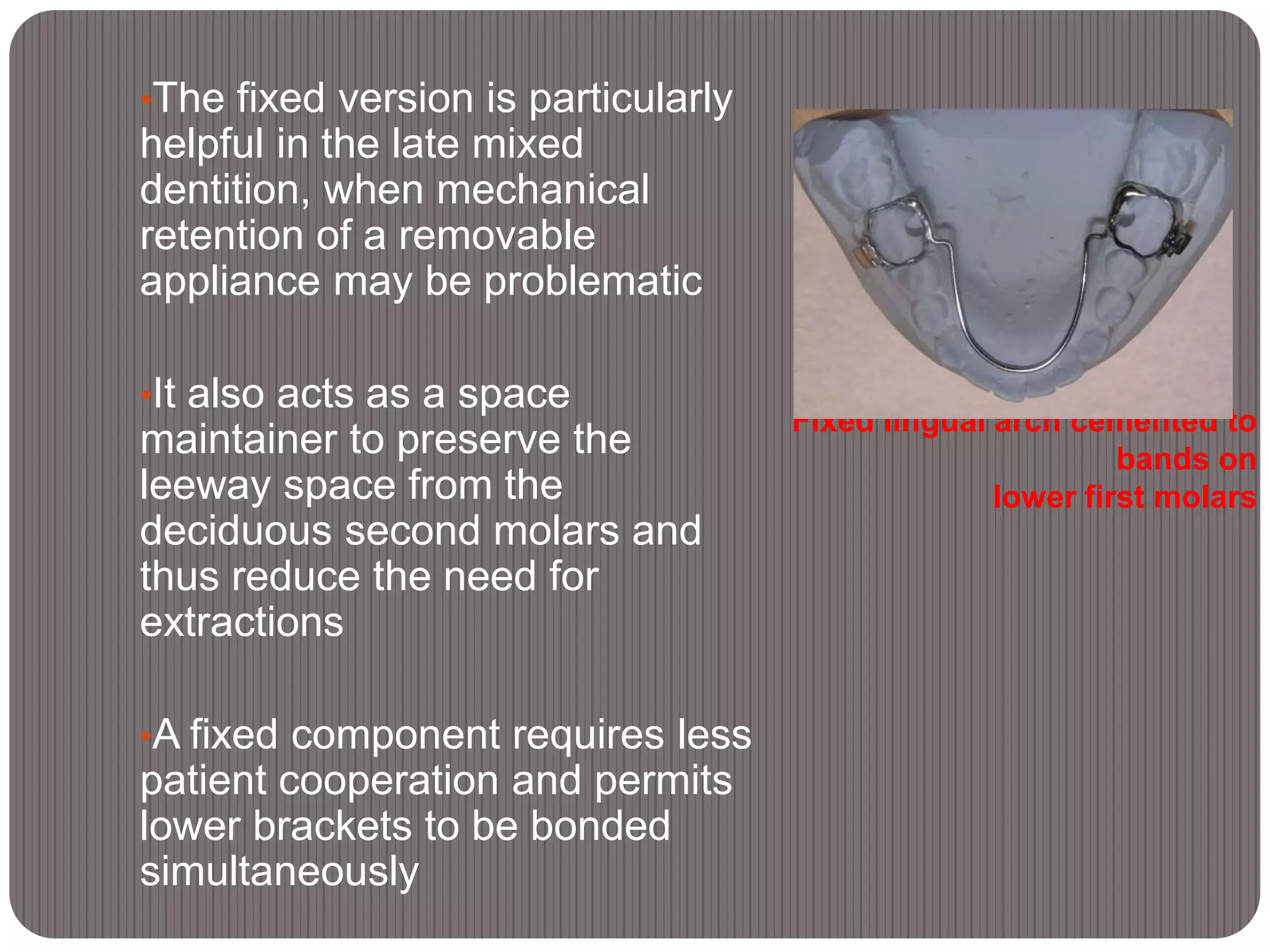 Fixed lingual arch cemented to
bands on
lower first molars
•The fixed version is particularly
helpful in the late mixed
dentition, when mechanical
retention of a removable
appliance may be problematic
•It also acts as a space
maintainer to preserve the
leeway space from the
deciduous second molars and
thus reduce the need for
extractions
•A fixed component requires less
patient cooperation and permits
lower brackets to be bonded
simultaneously
 