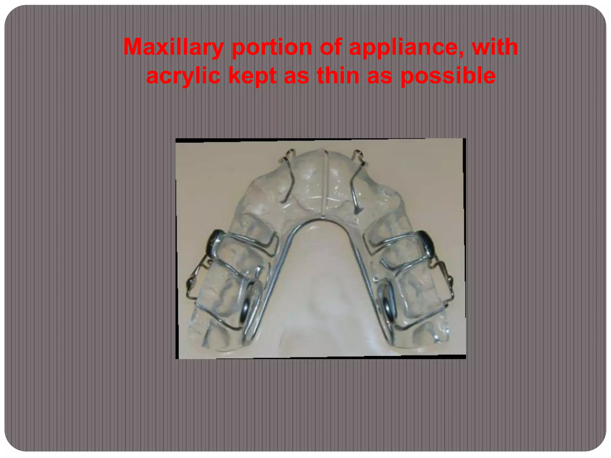 Maxillary portion of appliance, with
acrylic kept as thin as possible
 