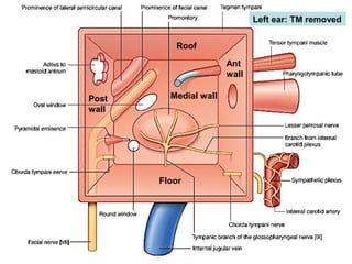 17
Left ear: TM removed
Roof
Floor
Medial wall
Ant
wall
Post
wall
 