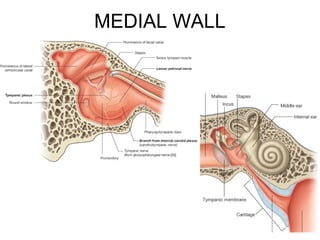 26
MEDIAL WALL
 