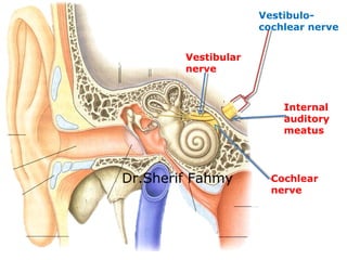Vestibular
nerve
Cochlear
nerve
Internal
auditory
meatus
Vestibulo-
cochlear nerve
Dr.Sherif Fahmy
 