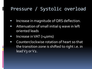 Extreme Counterclockwise Rotation Ecg The ECG in chmaber enlargement final.pptx