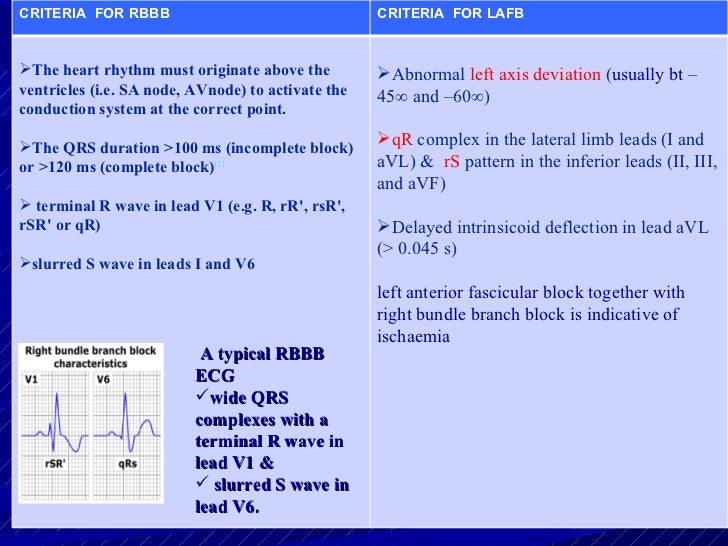 ECG RBBB with LAFB