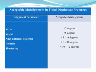 Alignment Tibia Acceptability The effect of intact fibula on functional outcome of reamed ...
