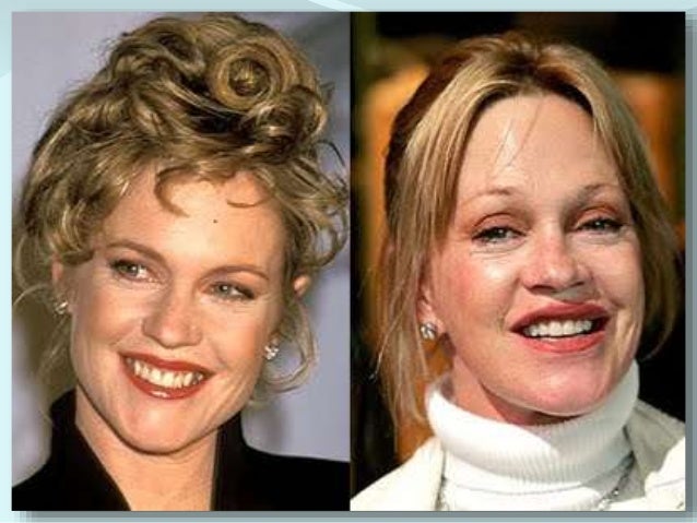 negative effects of plastic surgery The positive effects of cosmetic surgery on your relationship by advanced beauty cosmetic surgery | feb 10, 2016 | asian cosmetic surgery when you look in the mirror, you want to feel good. negative effects of plastic surgery The positive effects of cosmetic surgery on your relationship by advanced beauty cosmetic surgery | feb 10, 2016 | asian cosmetic surgery when you look in the mirror, you want to feel good.