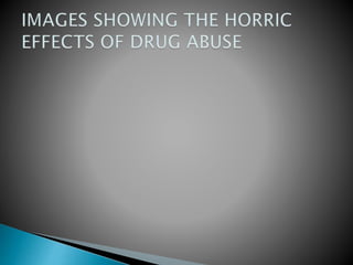 THE EFFECTS OF DRUG ABUSE ON YOUTHS__ama.pptx