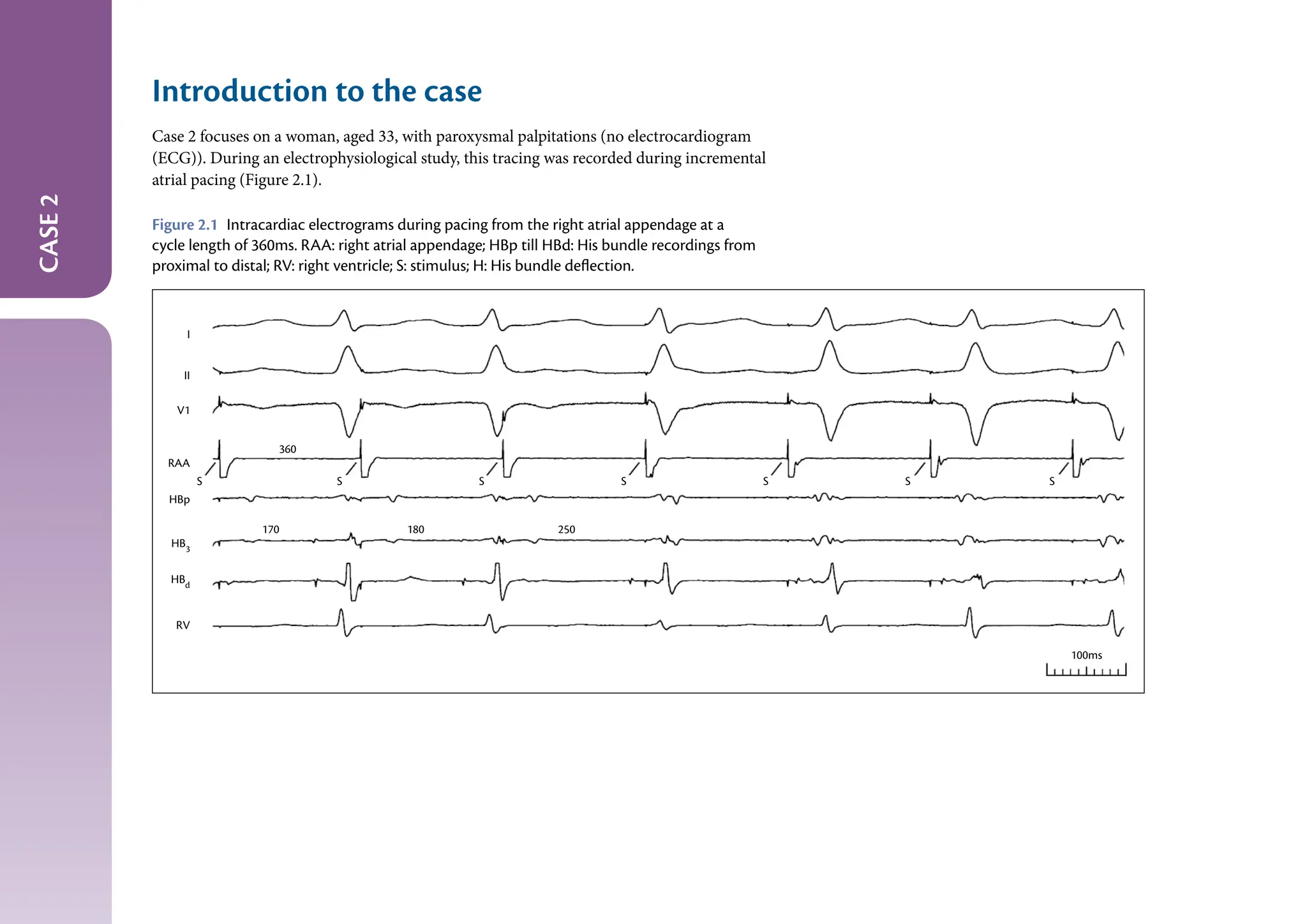 The_EHRA_Book_of_Interventiona