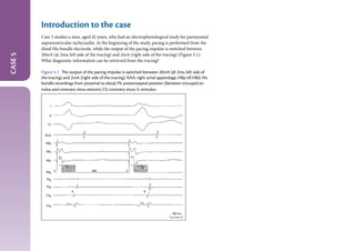 The_EHRA_Book_of_Interventional Electrophysiology.pdf