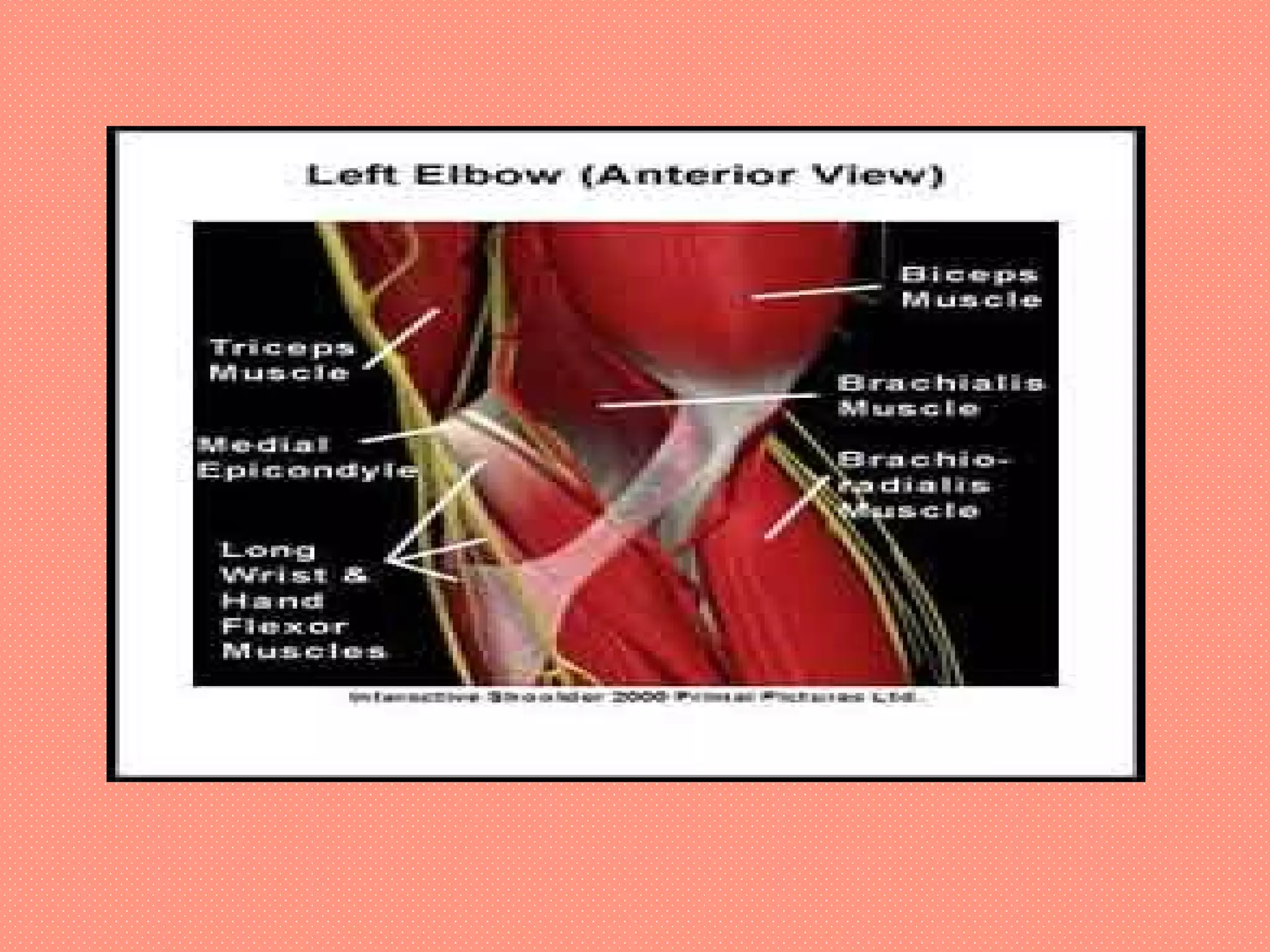 Elbow Tendon Rupture The elbow fracture | PPT