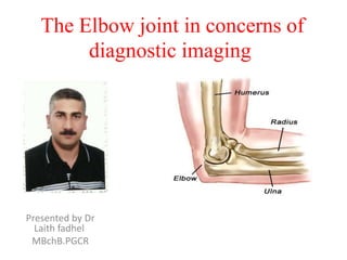 The Elbow joint in concerns of
diagnostic imaging

Presented by Dr
Laith fadhel
MBchB.PGCR

 
