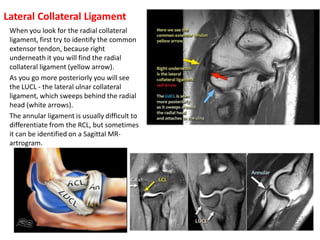 The elbow joint in concern of diagnostic imaging .pptx 1 | PPTX
