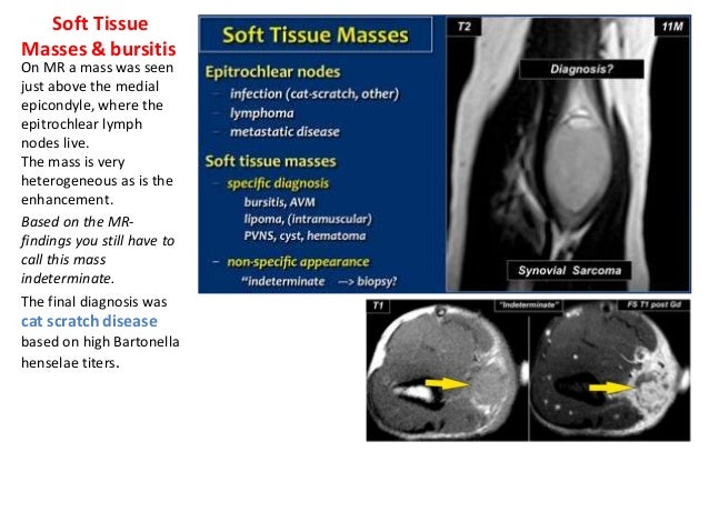 The elbow joint in concern of diagnostic imaging .pptx 1