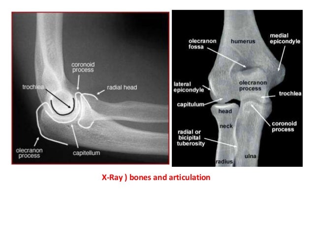 The elbow joint in concern of diagnostic imaging .pptx 1