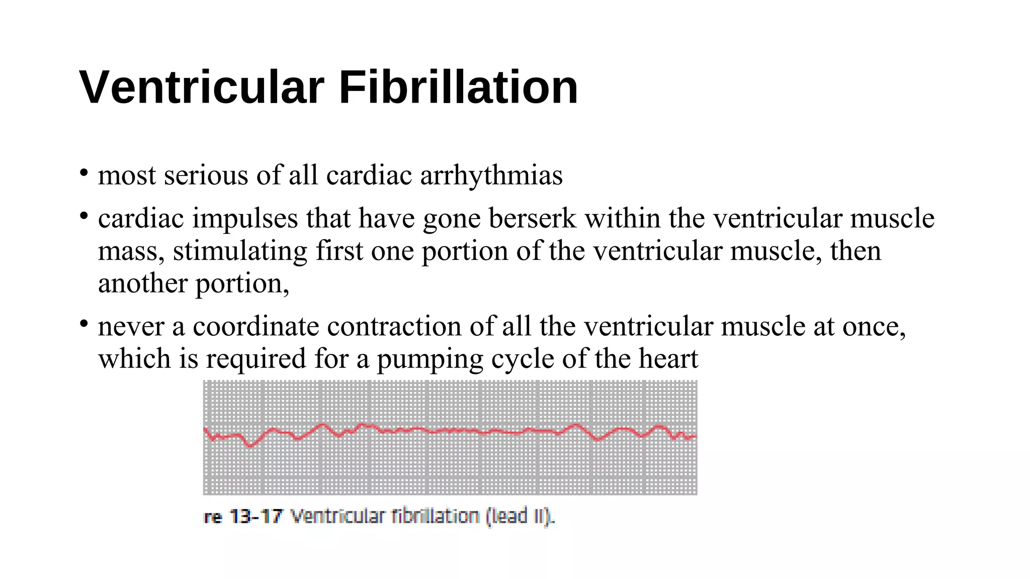 Ventricular Fibrillation
• most serious of all cardiac arrhythmias
• cardiac impulses that have gone berserk within the ventricular muscle
mass, stimulating first one portion of the ventricular muscle, then
another portion,
• never a coordinate contraction of all the ventricular muscle at once,
which is required for a pumping cycle of the heart
 