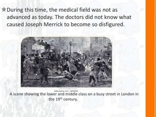 During this time, the medical field was not as
advanced as today. The doctors did not know what
caused Joseph Merrick to become so disfigured.
A scene showing the lower and middle class on a busy street in London in
the 19th century.
 