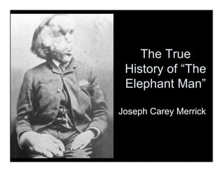 The True
History of “The
Elephant Man”
Joseph Carey Merrick
 