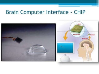 The Emerging World of Neuroprosthetics | PPTX