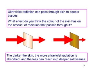 30
Ultraviolet radiation can pass through skin to deeper
tissues.
What effect do you think the colour of the skin has on
the amount of radiation that passes through it?
The darker the skin, the more ultraviolet radiation is
absorbed, and the less can reach into deeper soft tissues.
 