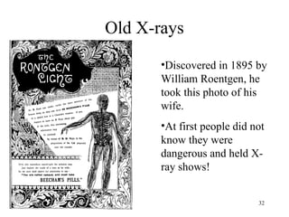 32
Old X-rays
•Discovered in 1895 by
William Roentgen, he
took this photo of his
wife.
•At first people did not
know they were
dangerous and held X-
ray shows!
 