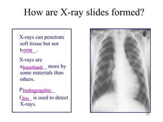 33
X-rays can penetrate
soft tissue but not
b_____.
X-rays are
a_________ more by
some materials than
others.
P____________
f____ is used to detect
X-rays.
How are X-ray slides formed?
one
bsorbed
hotographic
ilm
 