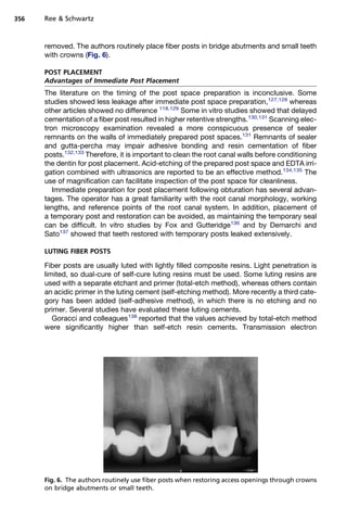 356   Ree  Schwartz



      removed. The authors routinely place fiber posts in bridge abutments and small teeth
      with crowns (Fig. 6).

      POST PLACEMENT
      Advantages of Immediate Post Placement
      The literature on the timing of the post space preparation is inconclusive. Some
      studies showed less leakage after immediate post space preparation,127,128 whereas
      other articles showed no difference 118,129 Some in vitro studies showed that delayed
      cementation of a fiber post resulted in higher retentive strengths.130,131 Scanning elec-
      tron microscopy examination revealed a more conspicuous presence of sealer
      remnants on the walls of immediately prepared post spaces.131 Remnants of sealer
      and gutta-percha may impair adhesive bonding and resin cementation of fiber
      posts.132,133 Therefore, it is important to clean the root canal walls before conditioning
      the dentin for post placement. Acid-etching of the prepared post space and EDTA irri-
      gation combined with ultrasonics are reported to be an effective method.134,135 The
      use of magnification can facilitate inspection of the post space for cleanliness.
         Immediate preparation for post placement following obturation has several advan-
      tages. The operator has a great familiarity with the root canal morphology, working
      lengths, and reference points of the root canal system. In addition, placement of
      a temporary post and restoration can be avoided, as maintaining the temporary seal
      can be difficult. In vitro studies by Fox and Gutteridge136 and by Demarchi and
      Sato137 showed that teeth restored with temporary posts leaked extensively.

      LUTING FIBER POSTS

      Fiber posts are usually luted with lightly filled composite resins. Light penetration is
      limited, so dual-cure of self-cure luting resins must be used. Some luting resins are
      used with a separate etchant and primer (total-etch method), whereas others contain
      an acidic primer in the luting cement (self-etching method). More recently a third cate-
      gory has been added (self-adhesive method), in which there is no etching and no
      primer. Several studies have evaluated these luting cements.
         Goracci and colleagues138 reported that the values achieved by total-etch method
      were significantly higher than self-etch resin cements. Transmission electron




      Fig. 6. The authors routinely use fiber posts when restoring access openings through crowns
      on bridge abutments or small teeth.
 