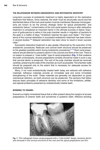 346   Ree  Schwartz


      THE RELATIONSHIP BETWEEN ENDODONTICS AND RESTORATIVE DENTISTRY

      Long-term success of endodontic treatment is highly dependent on the restorative
      treatment that follows. Once restored, the tooth must be structurally sound and the
      disinfected status of the root canal system must be maintained. Because microorgan-
      isms are known to be the primary etiologic factor for apical periodontitis1 and
      endodontic failure,2 contamination of the root canal system during or after restorative
      treatment is considered an important factor in the ultimate success or failure. Expo-
      sure of gutta-percha to saliva in the pulp chamber results in migration of bacteria to
      the apex in a matter of days.3 Endotoxin reaches the apex even faster.4 The impor-
      tance of the coronal restoration in successful endodontic treatment has been shown
      in several studies.5,6 Delayed restoration has been show to result in lower success
      rates.7
         Successful restorative treatment is also greatly influenced by the execution of the
      endodontic procedures. Radicular and coronal tooth structure should be preserved
      to the greatest possible extent during endodontic procedures.8–10 Root canal prepa-
      rations should attempt to preserve dentin in the coronal one-third of the root. There is
      no reason to prepare a ‘‘coke bottle’’ type of canal preparation (Fig. 1) that weakens
      the tooth unnecessarily. Access preparations similarly should be made in such a way
      that cervical dentin is preserved. The roof of the pulp chamber should be removed
      carefully, preserving the walls of the chamber as much as possible. The chamber walls
      should be prepared only to the extent that is necessary for adequate access for
      endodontic treatment.
         Many, if not most endodontically treated teeth today are restored with adhesive
      materials. Adhesive materials provide an immediate seal and some immediate
      strengthening of the tooth. These materials are generally not dependent on gross
      mechanical retention, so tooth structure can be preserved. The sections that follow
      discuss basic principles of adhesive dentistry and some of the limitations, pitfalls,
      and special problems presented by endodontically treated teeth.


      BONDING TO ENAMEL

      Enamel is a highly mineralized tissue that is often present along the margins of access
      preparations of anterior teeth and sometimes in posterior teeth. Effective bonding




      Fig. 1. This radiograph shows canals prepared with a ‘‘coke bottle’’ design. Excessive dentin
      was removed in the cervical one-third of the root and the apical preparations are thin.
 