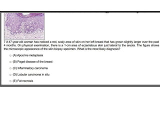 The Endocrine System Pathology | PPTX