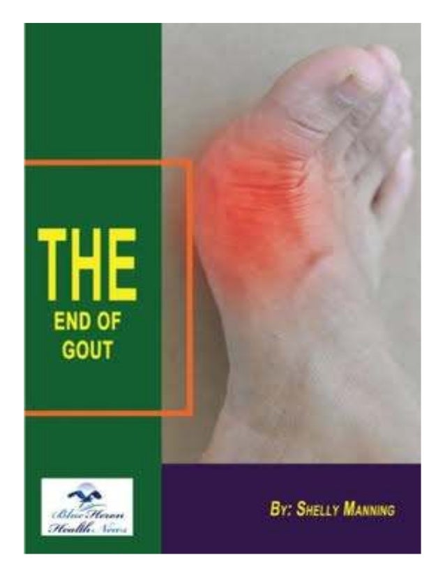 Shelly Manning: The End of Gout PDF, The End of Gout Free Download, The End of Gout eBook, The End
of Gout Reviews, The End of Gout Amazon, Buy The End of Gout Discount, The End of Gout Program,
The End of Gout Book For Sale, The End of Gout Diet, Probiotics For Gout, Can Probiotic Cure Gout.
 