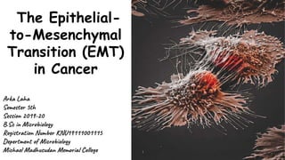 The Epithelial-
to-Mesenchymal
Transition (EMT)
in Cancer
Arka Laha
Semester 5th
Session 2019-20
B.Sc in Microbiology
Registration Number KNU19111001115
Depertment of Microbiology
Michael Madhusudan Memorial College
 