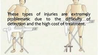 These types of injuries are extremely
problematic due to the difficulty of
detection and the high cost of treatment.
 