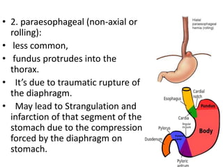 • 2. paraesophageal (non‐axial or
rolling):
• less common,
• fundus protrudes into the
thorax.
• It’s due to traumatic rupture of
the diaphragm.
• May lead to Strangulation and
infarction of that segment of the
stomach due to the compression
forced by the diaphragm on
stomach.
 