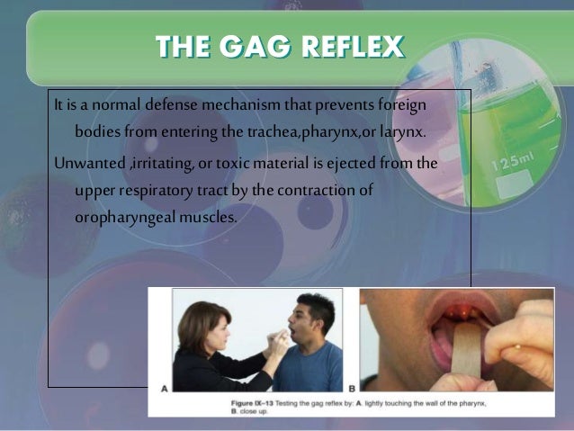 The Etiology And Management Of Gagging