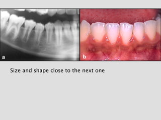 Size and shape close to the next one
 