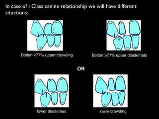 In case of I Class canine relationship we will have different
situations:
Bolton <77% upper crowding Bolton >77% upper diastemata
OR
lower diastemas lower crowding
 