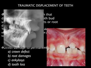Trauma to a primary tooth that
displaces the permanent tooth bud
underlying it ( enamel defects or root
distortion)
The term dilaceration, describes an abrupt deviation
of the long axis of the crown or root portion of the
tooth.	

!
!
Direct damage to permanent:	

a) crown defect	

b) root damages 	

c) ankylosys	

d) tooth loss
TRAUMATIC DISPLACEMENT OF TEETH
 