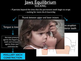 Jaws Equilibrium
- If persists beyond the time that the permanent teeth begin to erupt 	

- sucking for more tha 6 hours/day
Thumb between upper and lower incisors
SUCKING
decrease pressure by the tongue
against the lingual of upper posterior
teeth and increase check pressure
against these teeth (buccinatore
contracts during sucking)
MXILLARY ARCH
CONSTRICTION
ANTERIOR
OPEN BITE
Tongue is lowered
More eruption
posterior teeth
incisors eruption
impeded
 