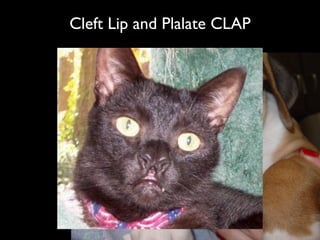 Cleft Lip and Plalate CLAP
 