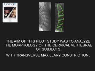 THE AIM OF THIS PILOT STUDY WAS TO ANALYZE
THE MORPHOLOGY OF THE CERVICAL VERTEBRAE
OF SUBJECTS
WITH TRANSVERSE MAXILLARY CONSTRICTION.
 