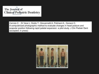 Cerruto C. , Di Vece L, Doldo T., Giovannetti A, Polimeni A., Goracci C.
A computerized photographic method to evaluate changes in head posture and
scapular position following rapid palatal expansion: a pilot study. J Clin Pediatr Dent
(accepted; in press)
 