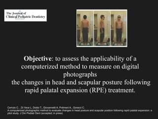 Cerruto C. , Di Vece L, Doldo T., Giovannetti A, Polimeni A., Goracci C.
A computerized photographic method to evaluate changes in head posture and scapular position following rapid palatal expansion: a
pilot study. J Clin Pediatr Dent (accepted; in press)
Objective: to assess the applicability of a
computerized method to measure on digital
photographs
the changes in head and scapular posture following
rapid palatal expansion (RPE) treatment.
 