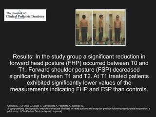 Cerruto C. , Di Vece L, Doldo T., Giovannetti A, Polimeni A., Goracci C.
A computerized photographic method to evaluate changes in head posture and scapular position following rapid palatal expansion: a
pilot study. J Clin Pediatr Dent (accepted; in press)
Results: In the study group a significant reduction in
forward head posture (FHP) occurred between T0 and
T1. Forward shoulder posture (FSP) decreased
significantly between T1 and T2. At T1 treated patients
exhibited significantly lower values of the
measurements indicating FHP and FSP than controls.
 