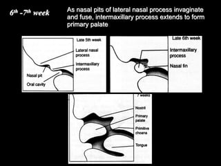 6th -7th week As nasal pits of lateral nasal process invaginate
and fuse, intermaxillary process extends to form
primary palate
 