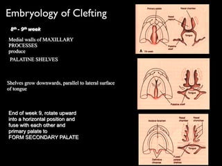 8th - 9th week
Medial walls of MAXILLARY
PROCESSES
produce
PALATINE SHELVES
Shelves grow downwards, parallel to lateral surface
of tongue
End of week 9, rotate upward
into a horizontal position and
fuse with each other and
primary palate to
FORM SECONDARY PALATE
Embryology of Clefting
 