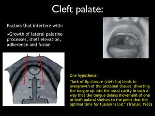 Cleft palate:
•Growth of lateral palatine
processes, shelf elevation,
adherence and fusion
Factors that interfere with:
One hypothesis:
“lack of lip closure (cleft lip) leads to
overgrowth of the prolabial tissues, diverting
the tongue up into the nasal cavity in such a
way that the tongue delays movement of one
or both palatal shelves to the point that the
optimal time for fussion is lost” (Trasler, 1968)
 