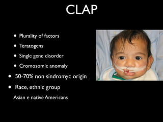 CLAP
!
• Plurality of factors	

• Teratogens	

• Single gene disorder	

• Cromosomic anomaly 	

• 50-70% non sindromyc origin	

• Race, ethnic group	

Asian e native Americans
 
