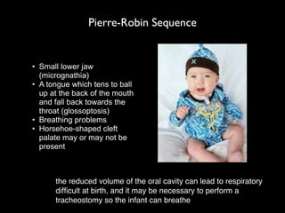 Pierre-Robin Sequence
• Small lower jaw
(micrognathia)
• A tongue which tens to ball
up at the back of the mouth
and fall back towards the
throat (glossoptosis)
• Breathing problems
• Horsehoe-shaped cleft
palate may or may not be
present
the reduced volume of the oral cavity can lead to respiratory
difﬁcult at birth, and it may be necessary to perform a
tracheostomy so the infant can breathe
 