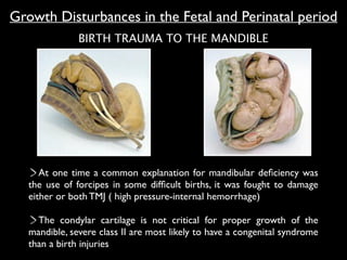 BIRTH TRAUMA TO THE MANDIBLE
At one time a common explanation for mandibular deﬁciency was
the use of forcipes in some difﬁcult births, it was fought to damage
either or both TMJ ( high pressure-internal hemorrhage)	

!
The condylar cartilage is not critical for proper growth of the
mandible, severe class II are most likely to have a congenital syndrome
than a birth injuries
Growth Disturbances in the Fetal and Perinatal period
 