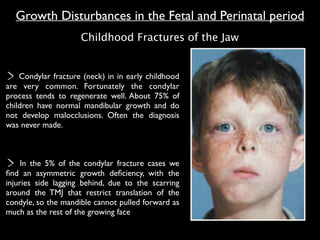 Condylar fracture (neck) in in early childhood
are very common. Fortunately the condylar
process tends to regenerate well. About 75% of
children have normal mandibular growth and do
not develop malocclusions. Often the diagnosis
was never made.
In the 5% of the condylar fracture cases we
ﬁnd an asymmetric growth deﬁciency, with the
injuries side lagging behind, due to the scarring
around the TMJ that restrict translation of the
condyle, so the mandible cannot pulled forward as
much as the rest of the growing face
Growth Disturbances in the Fetal and Perinatal period
Childhood Fractures of the Jaw
 